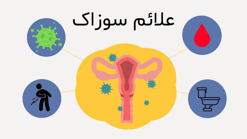 سوزاک در بیمارستان مجازی ایران
