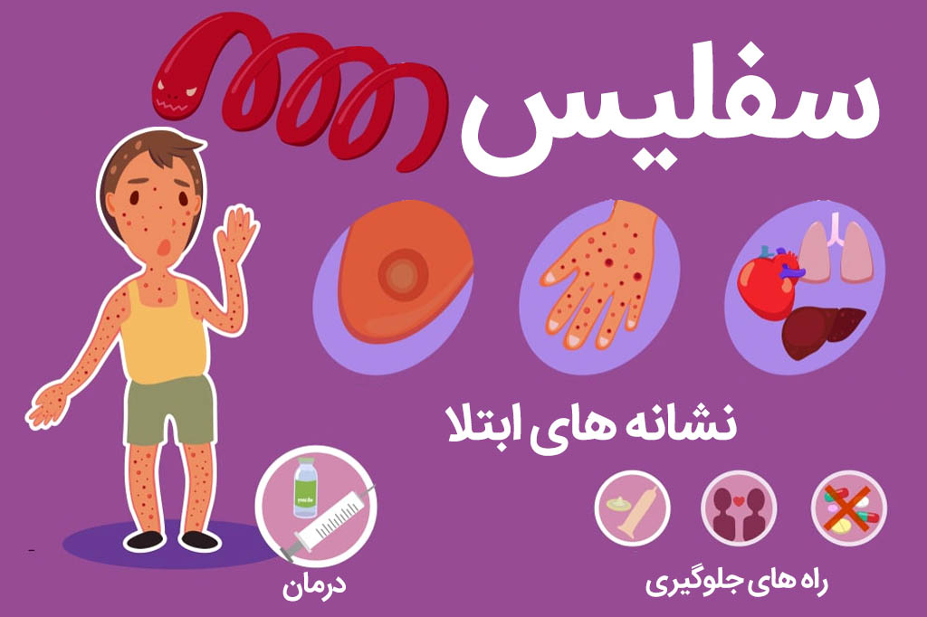 سفلیس چیست